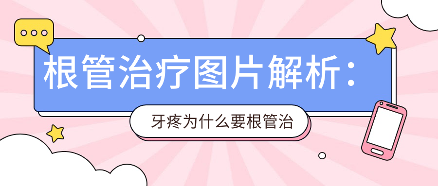 根管治疗图片解析：牙疼为什么要根管治疗？牙科收费价目表详解