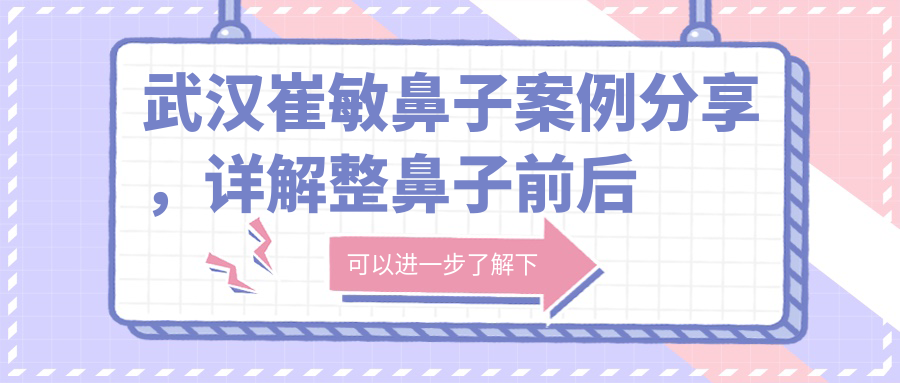 武汉崔敏鼻子案例分享,详解整鼻子前后对比及注意事项
