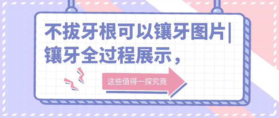 不拔牙根可以镶牙图片 不拔牙根可以镶牙图片