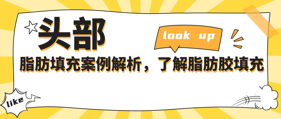 凹陷疤痕脂肪填充成功案例 凹陷疤痕脂肪填充成功案例