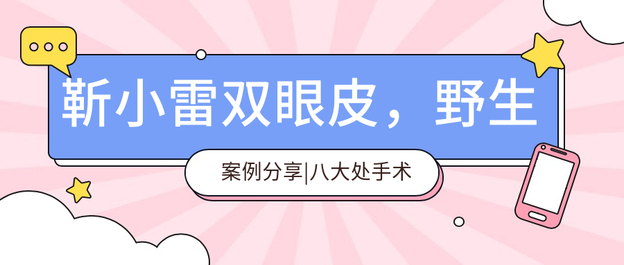 靳小雷双眼皮野生案例